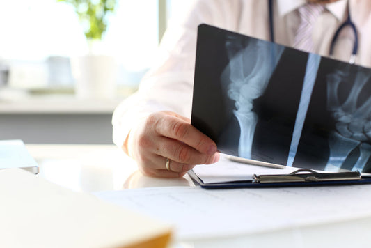 Osteoporosis Prevention & How to Maintain Bone Health